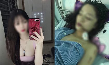 Công an lên tiếng vụ cô gái xinh đẹp bị bạn thân rạch mặt kinh hoàng ở Bắc Ninh