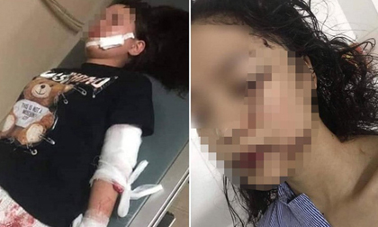 Những chi tiết rợn người qua lời kể của 2 cô gái tham gia vụ rạch mặt thiếu nữ xinh đẹp