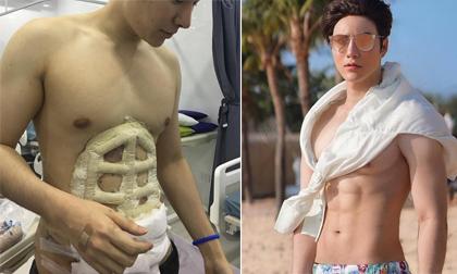 Tập hoài không lên cơ bụng 6 múi, anh chàng quyết định phẫu thuật thẩm mỹ luôn cho nhanh