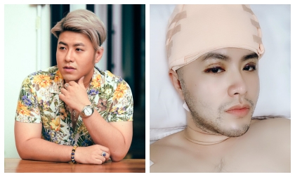 Akira Phan: 'Mỗi lần gặp khán giả đều chê mập đến mức tôi stress cực độ nên quyết định thẩm mĩ'