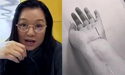 Hoa hậu gợi cảm nhất Hong Kong phát tướng sau 7 năm điều trị u não