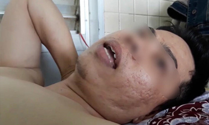 Đình chỉ nhân viên y tế khoan nhầm cẳng chân bệnh nhân