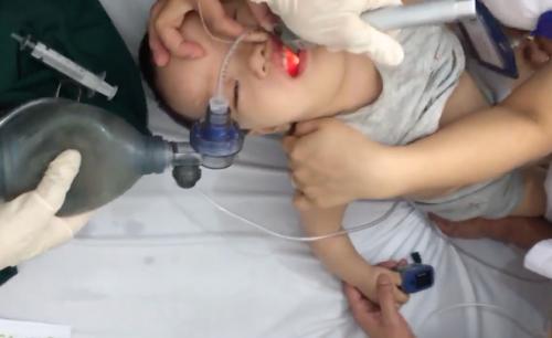 7 phút sinh tử cứu bé trai 21 tháng tuổi bị hóc thạch rau câu