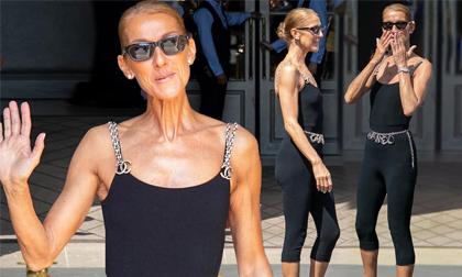 Celine Dion nổi cả mảng gân ở cổ và tay khi được người tình tin đồn hộ tống trên phố