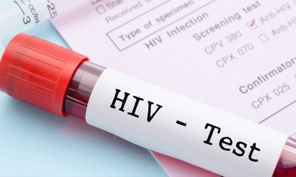 Lần đầu tiên các nhà khoa học loại bỏ được HIV trong toàn bộ gen của chuột: Đem lại hi vọng loại bỏ HIV ở người
