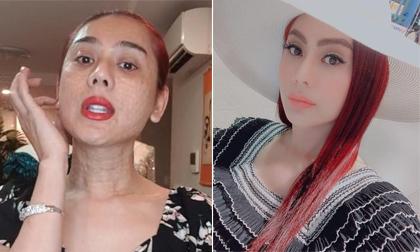 Lâm Khánh Chi xuất hiện với gương mặt căng mượt sau khi bị chê da sần sùi, nở nốt đáng sợ 