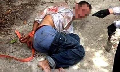 Tranh cãi tiền lãi, con nợ rút dao cứa cổ chủ nợ ở Nam Định