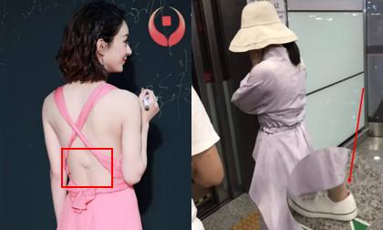 Sau vết sẹo 10 năm chưa lành, Triệu Lệ Dĩnh lại khiến fan xót xa vì chân bị trầy xước khi lẩn tránh sự săn đuổi của phóng viên
