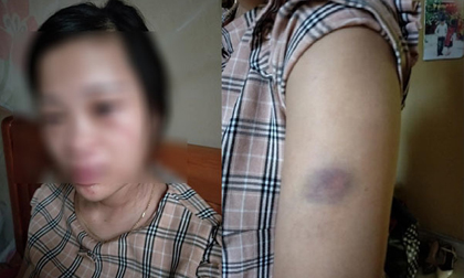 Diễn biến mới vụ mua giày 135 ngàn, vợ mang thai 8 tháng bị chồng đánh