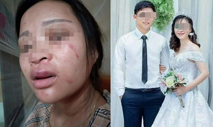 Mẹ thai phụ 8 tháng bị chồng đánh dã man vì mua giày 135 ngàn: 'Cháu ngoại tôi sắp chào đời, nó cần có bố bên cạnh'