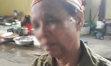 Nghi án con trai làm ngơ để vợ ngược đãi mẹ ruột, đánh mẹ bầm tím mặt rồi không cho ăn cơm