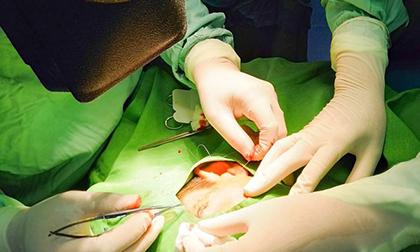 Bé trai bị ngòi bút chì đâm vào hốc mắt khi đùa nghịch cùng bạn, dị vật nằm lại suốt 5 năm