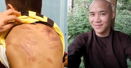 Đề nghị khởi tố gã cư sĩ biến thái có hành vi ấu dâm, bạo hành bé trai ở Bình Thuận