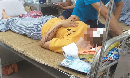 Người phụ nữ kể lại giây phút bất ngờ bị kẻ lạ cầm cốc axit hất thẳng vào mặt