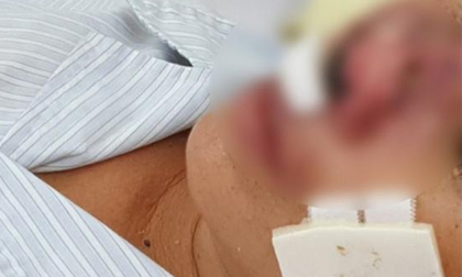 Bệnh Whitmore ăn mòn cơ thể có lây từ người sang người?