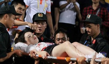 Khởi tố, tạm giam kẻ bắn pháo sáng trên sân Hàng Đẫy khiến nữ CĐV bị thương 