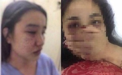 Bộ Y tế yêu cầu xử nghiêm vụ nữ điều dưỡng tố bị bác sĩ gạ tình, đánh đập