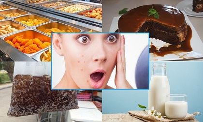 4 nhóm thực phẩm gây mụn trứng cá bạn cần phải biết