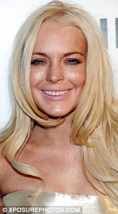 Lindsay Lohan,lộ,răng... sún