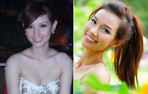 Quỳnh Chi, Miss Teen, Phẫu thuật thẩm mỹ, Chuyện của sao