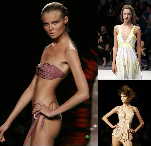 Siêu mẫu gầy kinh dị xuất hiện trong Milan FW, Thời trang, mau sieu gay, tuan le thoi trang milan, tuan le thoi trang, san dien thoi trang, nguoi mau quóc te