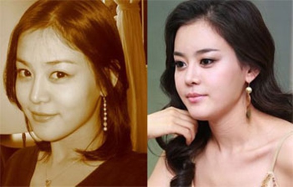 Sốc với loạt hoa hậu,có mũi 'dao kéo' y hệt