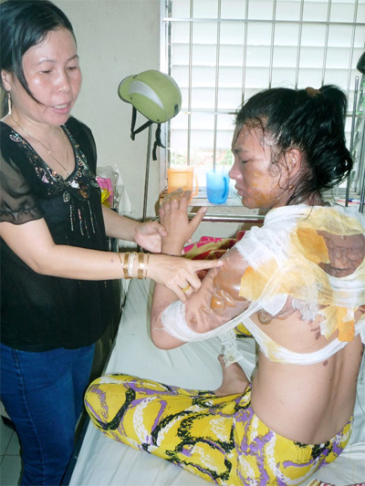 bạo hành gia đình,chồng đánh vợ,chồng dội nước sôi lên người vợ