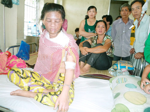 bạo hành gia đình,chồng đánh vợ,chồng dội nước sôi lên người vợ