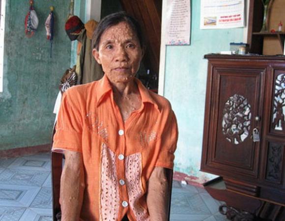 chuyện lạ,chuyện lạ việt nam,phi thường,kỳ quặc,phụ nữ việt nam