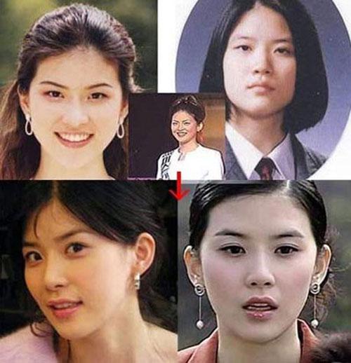 hoa hậu,hoa hậu hàn quốc,phẫu thuật thẩm mỹ,Kim Sa Rang,Park Si Yeon