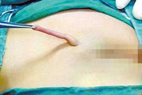Chuyện lạ,chuyện lạ thế giới,phi thường,kỳ quặc,mọc đuôi