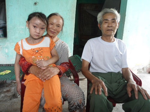 chuyện lạ,chuyện lạ việt nam,phi thường,kỳ quặc,dị nhân,mắt ma