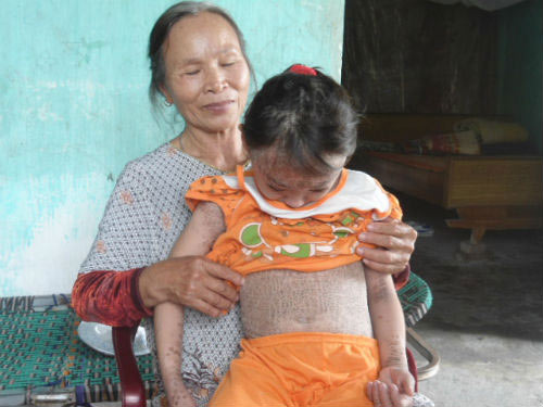chuyện lạ,chuyện lạ việt nam,phi thường,kỳ quặc,dị nhân,mắt ma