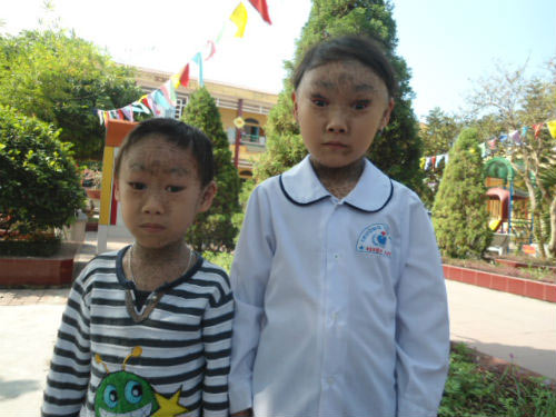 chuyện lạ,chuyện lạ việt nam,phi thường,kỳ quặc,dị nhân,mắt ma