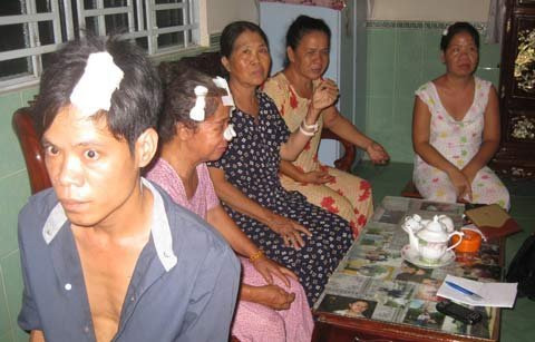 Đốt nhà,đổ xăng đốt nhà,thiêu sống,thiêu sống người thân
