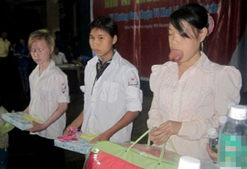 Chuyện lạ,chuyện lạ thế giới,phi thường,kỳ quặc,chiếc lưỡi kỳ lạ