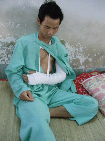 Cướp chém lìa tay,cướp tài sản,cướp giật,cướp chém người dã man