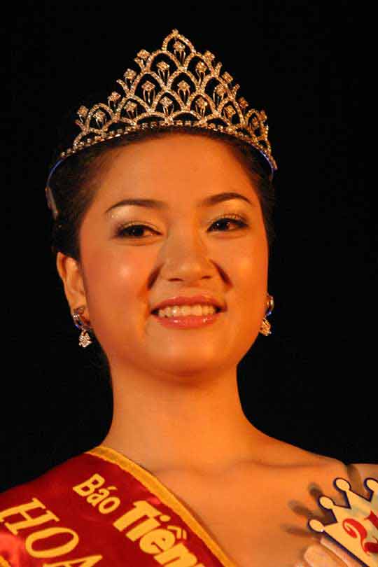 Nghi án dao kéo,phẫu thuật thẩm mỹ,minh hằng,hoa hậu thùy dung,