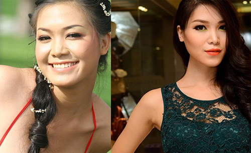 Nghi án dao kéo,phẫu thuật thẩm mỹ,minh hằng,hoa hậu thùy dung,
