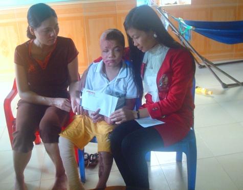 Cháu bé bỏng nặng,lấy da vá da,cháu bé bỏng được hỗ trợ