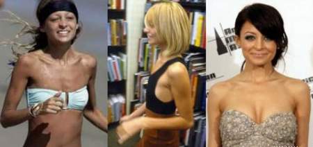 ngực,dao kéo,phẫu thuật,nâng ngực,sao Hollywood,Pamela Anderson,Rihanna 