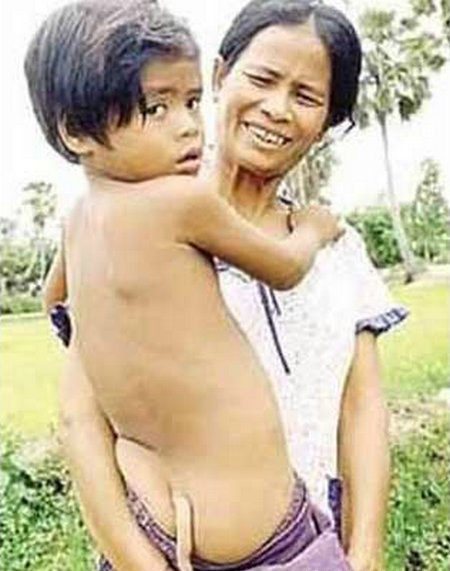 Chuyện lạ,chuyện lạ thế giới,phi thường,kỳ quặc,đuôi người