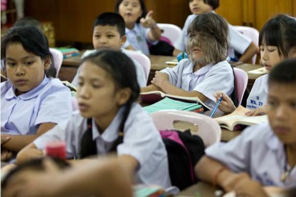 Chuyện lạ,chuyện lạ thế giới,phi thường,kỳ quặc,cô bé sói