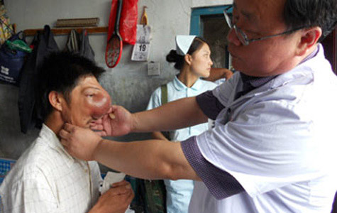 Chuyện lạ,chuyện lạ thế giới,phi thường,kỳ quặc,dị dạng,khuôn mặt biến dạng