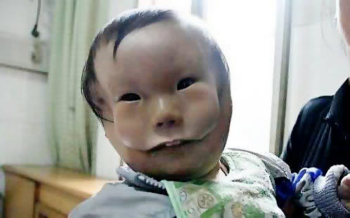 Chuyện lạ,chuyện lạ thế giới,phi thường,kỳ quặc,dị dạng,khuôn mặt biến dạng