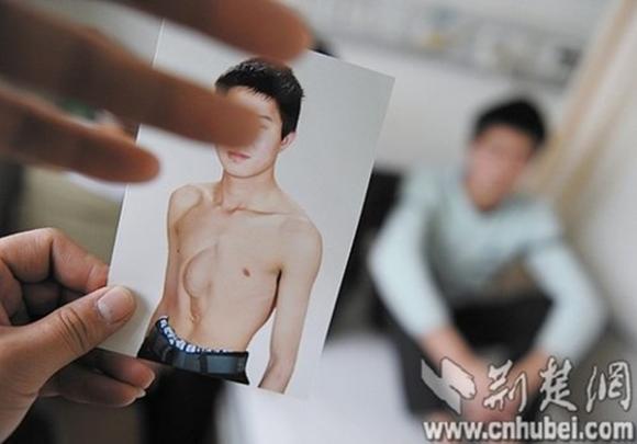 Chuyện lạ,chuyện lạ thế giới,phi thường,kỳ quặc,tim ngoài lồng ngực