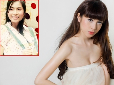 Sao việt,phẫu thuật thẩm mỹ,Kim hiền,Thủy tiên