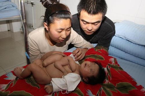 Chuyện lạ,chuyện lạ thế giới,phi thường,kỳ quặc,bé gái,bé giá 5 chân