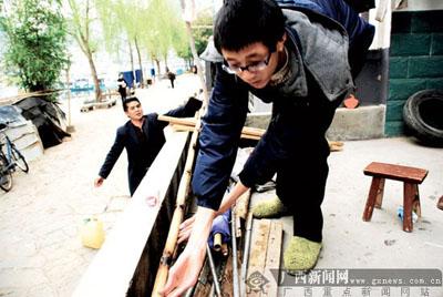 Chuyện lạ,chuyện lạ thế giới,phi thường,kỳ quặc,người nhện,bệnh lạ