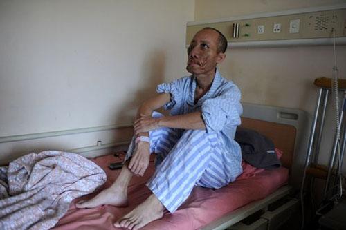 Chuyện lạ,chuyện lạ thế giới,phi thường,kỳ quặc,khối u